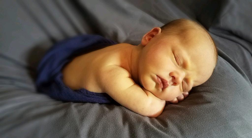 Entenda o que é Ictericia neonatal