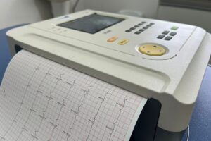 ecocardiograma equipamento médico exames