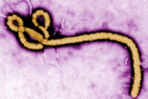 Ebola_virus_purple