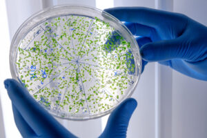 bactéria contaminação FreePik